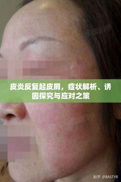 皮炎反复起皮屑，症状解析、诱因探究与应对之策