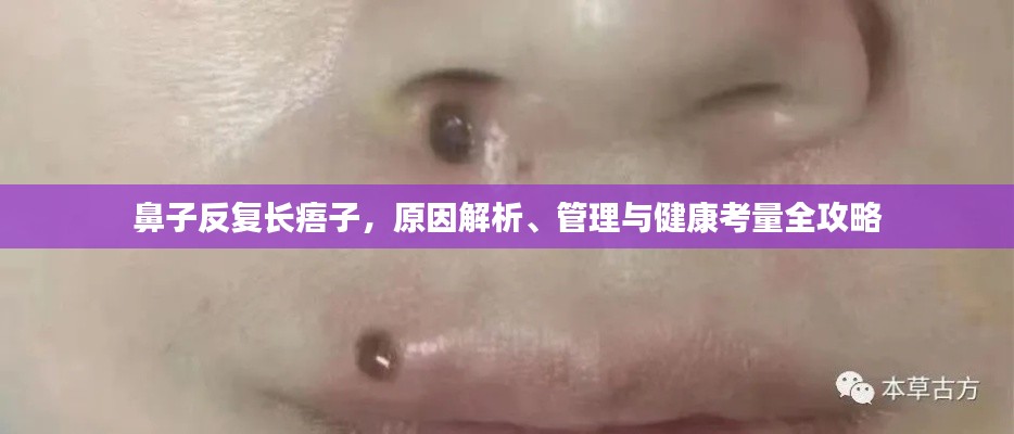 鼻子反复长痦子，原因解析、管理与健康考量全攻略