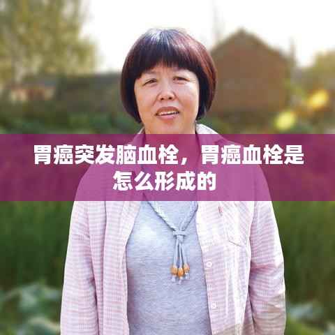 胃癌突发脑血栓，胃癌血栓是怎么形成的 