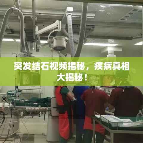 突发结石视频揭秘,疾病真相大揭秘!