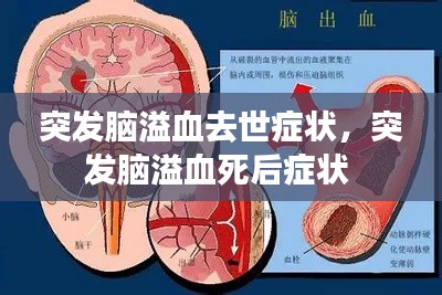 突发脑溢血去世症状，突发脑溢血死后症状 