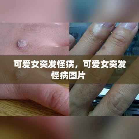 可爱女突发怪病，可爱女突发怪病图片 