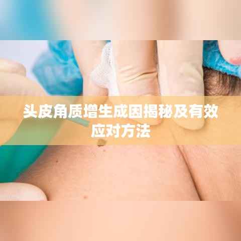 头皮角质增生成因揭秘及有效应对方法