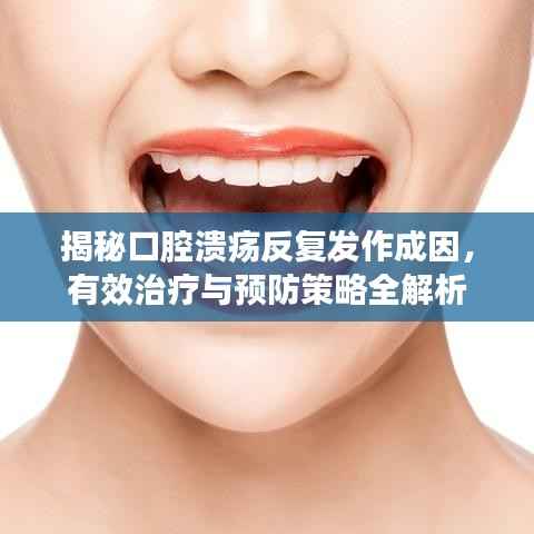 揭秘口腔溃疡反复发作成因,有效治疗与预防策略全解析