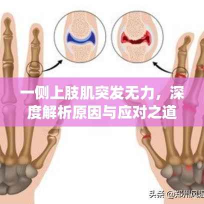 一侧上肢肌突发无力，深度解析原因与应对之道