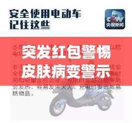 突发红包警惕皮肤病变警示信号，皮肤健康紧急提醒！