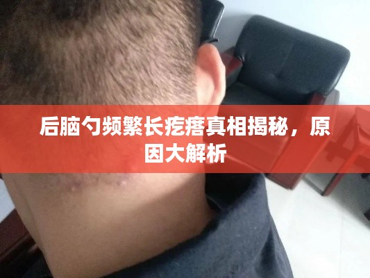 后脑勺频繁长疙瘩真相揭秘，原因大解析