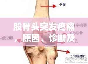 股骨头突发疼痛，原因、诊断及治疗方法解析