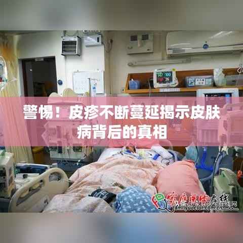 警惕！皮疹不断蔓延揭示皮肤病背后的真相